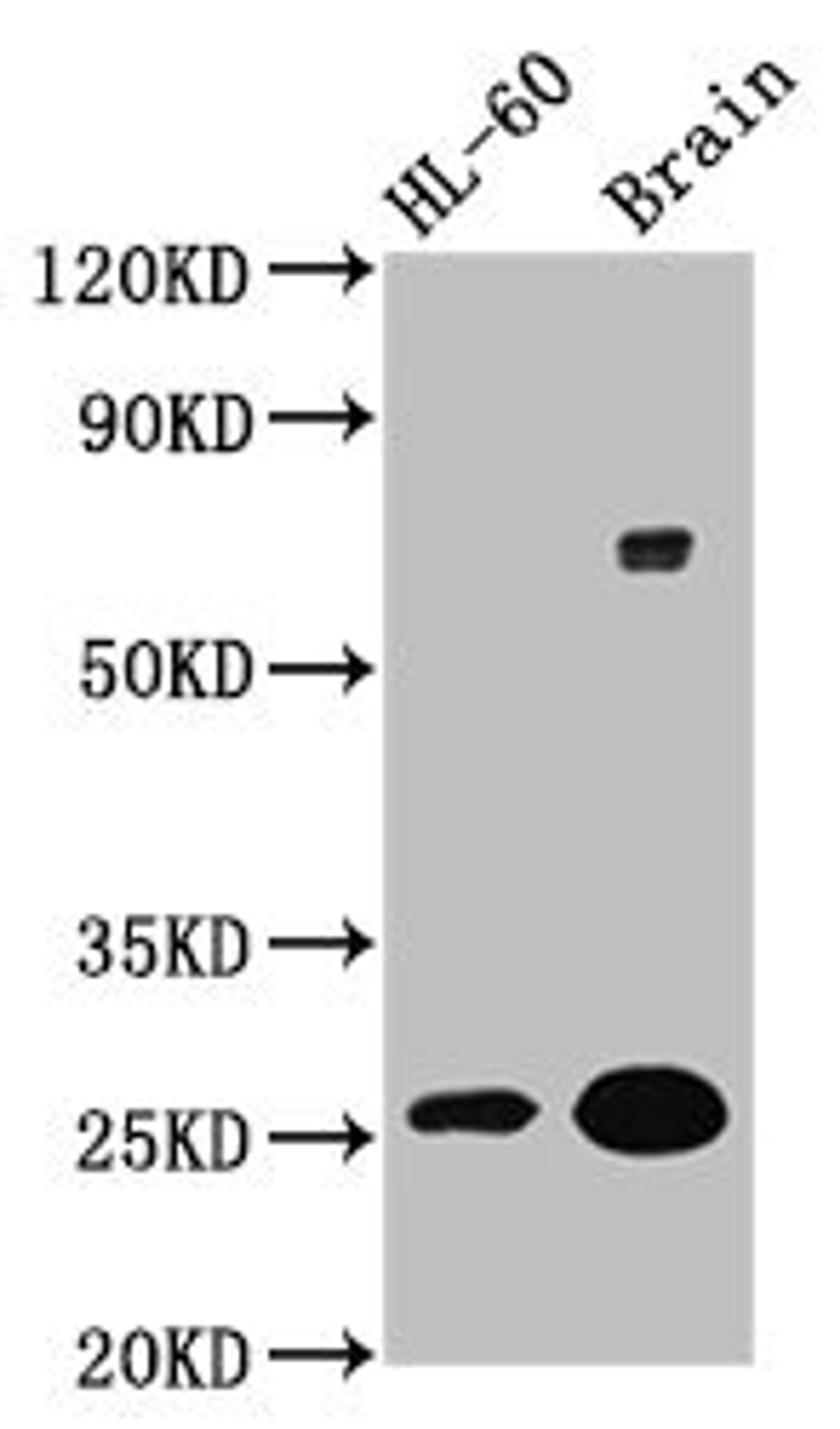 Western Blot. Positive WB detected in: HL60 whole cell lysate, Rat brain tissue. All lanes: FEV antibody at 5.9µg/ml. Secondary. Goat polyclonal to rabbit IgG at 1/50000 dilution. Predicted band size: 26 kDa. Observed band size: 26 kDa