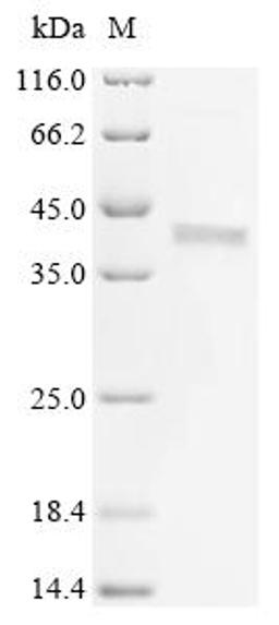 (Tris-Glycine gel) Discontinuous SDS-PAGE (reduced) with 5% enrichment gel and 15% separation gel.