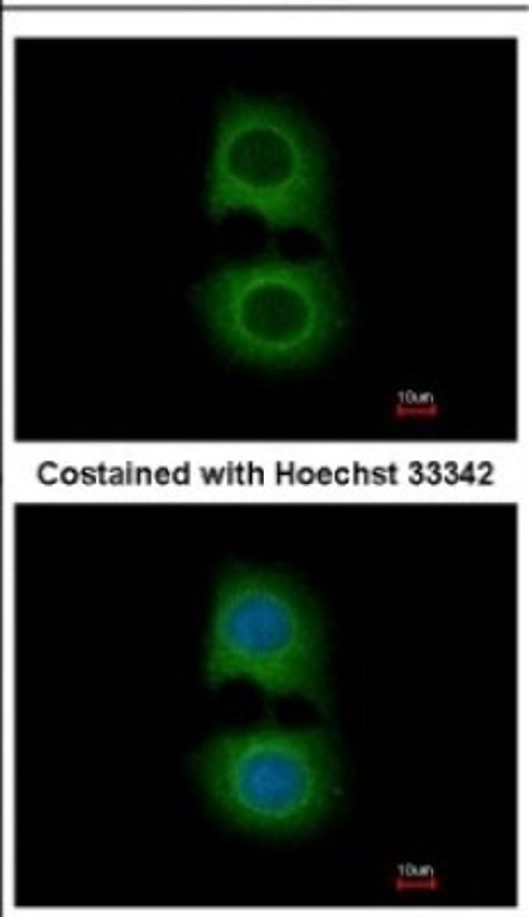 Immunocytochemistry/Immunofluorescence: Tropomodulin 2 Antibody [NBP2-20730] - Immunofluorescence analysis of methanol-fixed MCF-7, using antibody at 1:200 dilution.