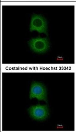 Immunocytochemistry/Immunofluorescence: Tropomodulin 2 Antibody [NBP2-20730] - Immunofluorescence analysis of methanol-fixed MCF-7, using antibody at 1:200 dilution.