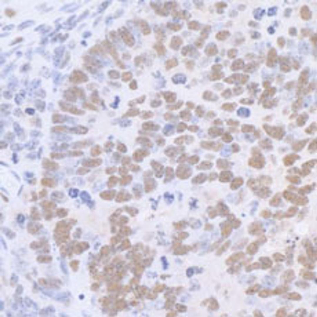 Detection of mouse SP1 by immunohistochemistry.