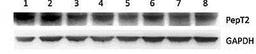 Western blot analysis of endogenous (canine) PepT2 in wild-type and transfected MDCKII cell line (lane 1), MDCKII-wt(lane 2), MDCKII-wt(lane 3), MDCKII-MDR1(lane 4),MDCKII-MDR1(lane 5), MDCKII-MRP2(lane 6), MDCKII-MRP2(lane 7), MDCKII-BCRP(lane 8) using P