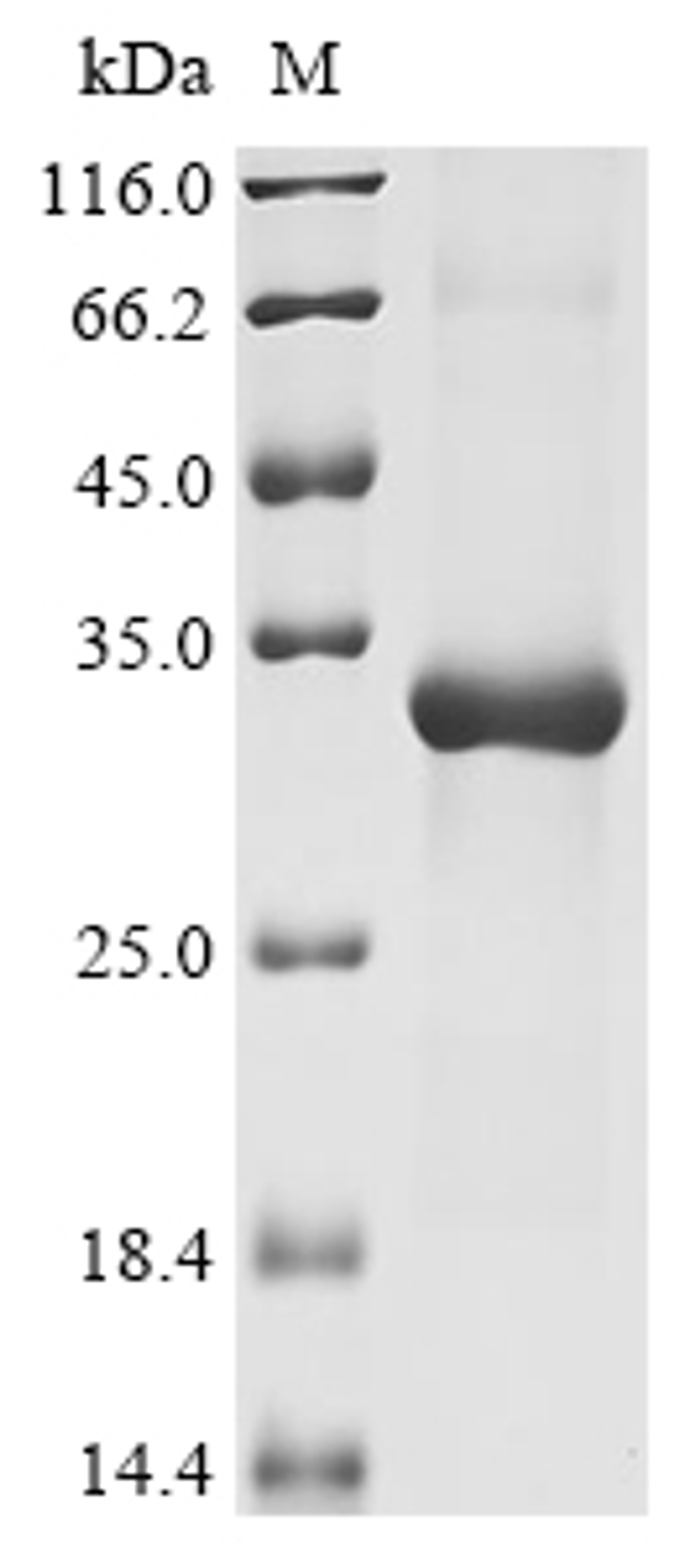 (Tris-Glycine gel) Discontinuous SDS-PAGE (reduced) with 5% enrichment gel and 15% separation gel.