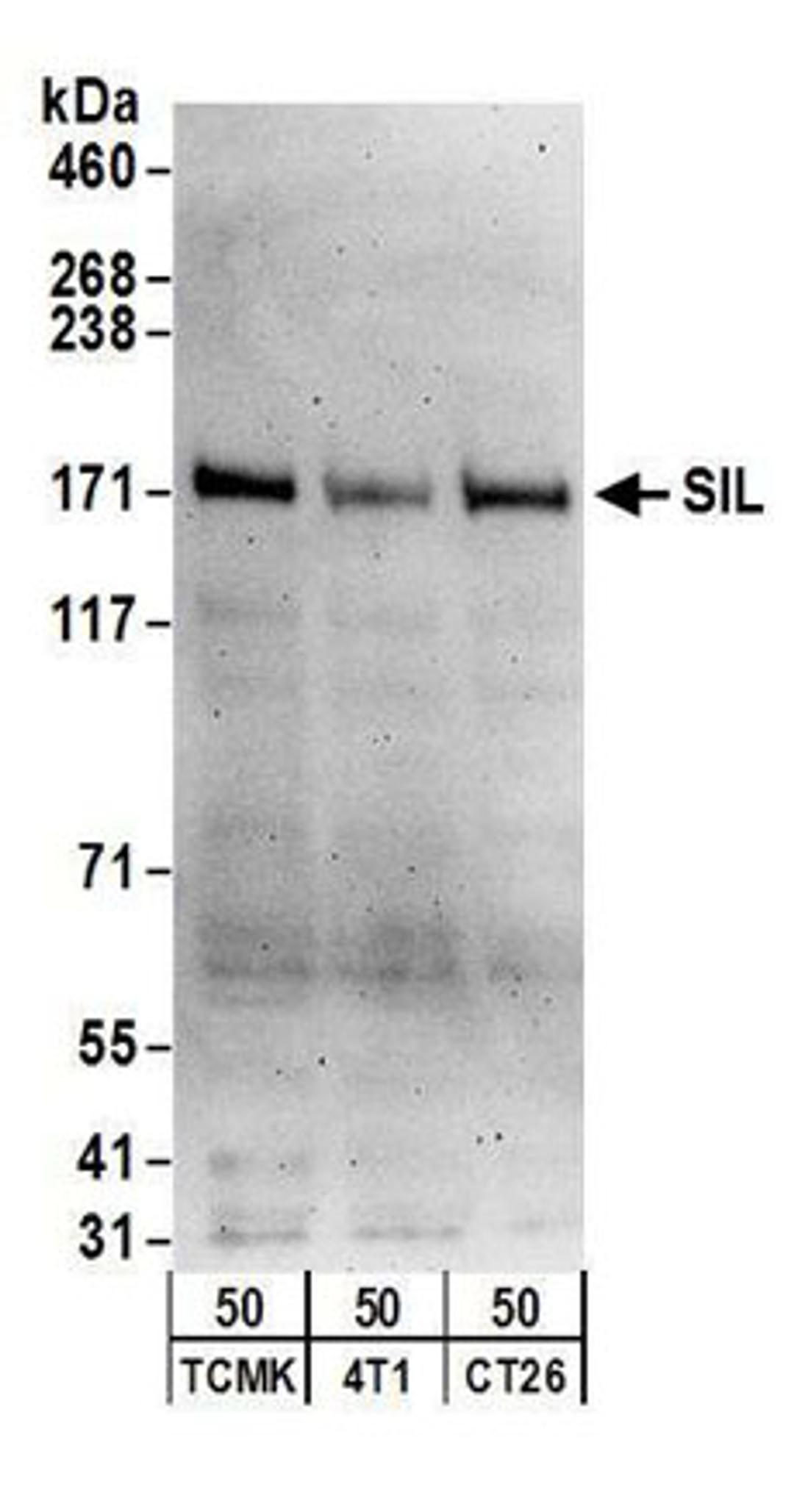 Detection of mouse SIL by western blot.