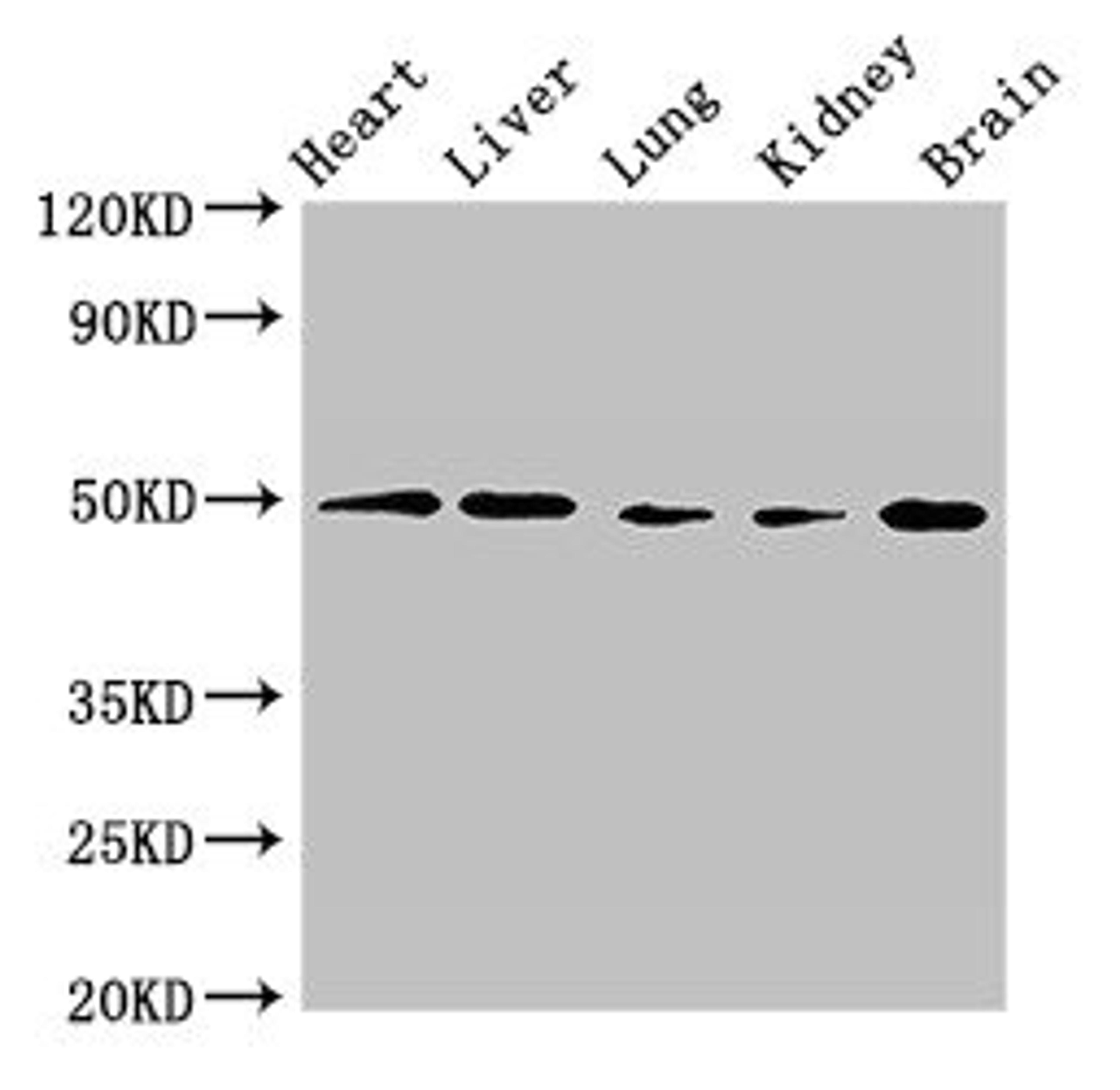 Western Blot. Positive WB detected in: Mouse heart tissue, Mouse liver tissue, Mouse lung tissue, Mouse kidney tissue, Mouse brain tissue. All lanes: GPR22 antibody at 2.5ug/ml. Secondary. Goat polyclonal to rabbit IgG at 1/50000 dilution. Predicted band size: 50 kDa. Observed band size: 50 kDa. 