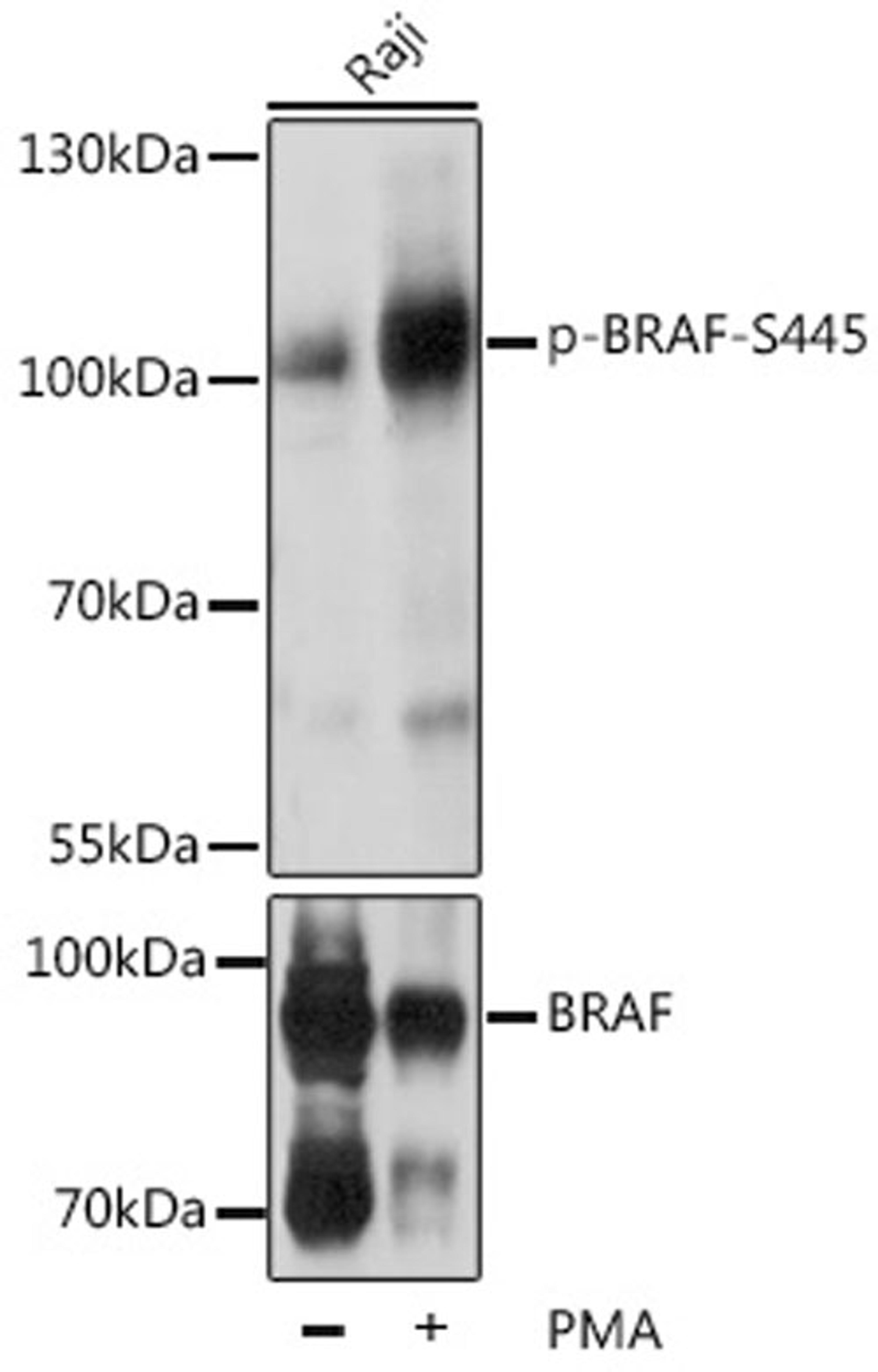 Western blot - Phospho-BRAF-S445 pAb (AP0012)