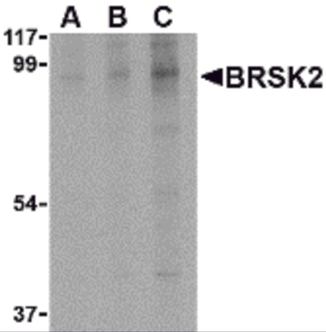 Western blot analysis of BRSK2 in human brain tissue lysate with BRSK2 antibody at (A) 0.5, (B) 1 and (C) 2 &#956;g/mL.