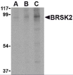 Western blot analysis of BRSK2 in human brain tissue lysate with BRSK2 antibody at (A) 0.5, (B) 1 and (C) 2 &#956;g/mL.