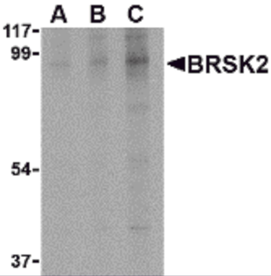 Western blot analysis of BRSK2 in human brain tissue lysate with BRSK2 antibody at (A) 0.5, (B) 1 and (C) 2 μg/mL.