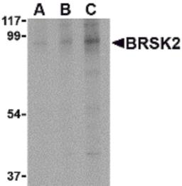 Western blot analysis of BRSK2 in human brain tissue lysate with BRSK2 antibody at (A) 0.5, (B) 1 and (C) 2 μg/mL.