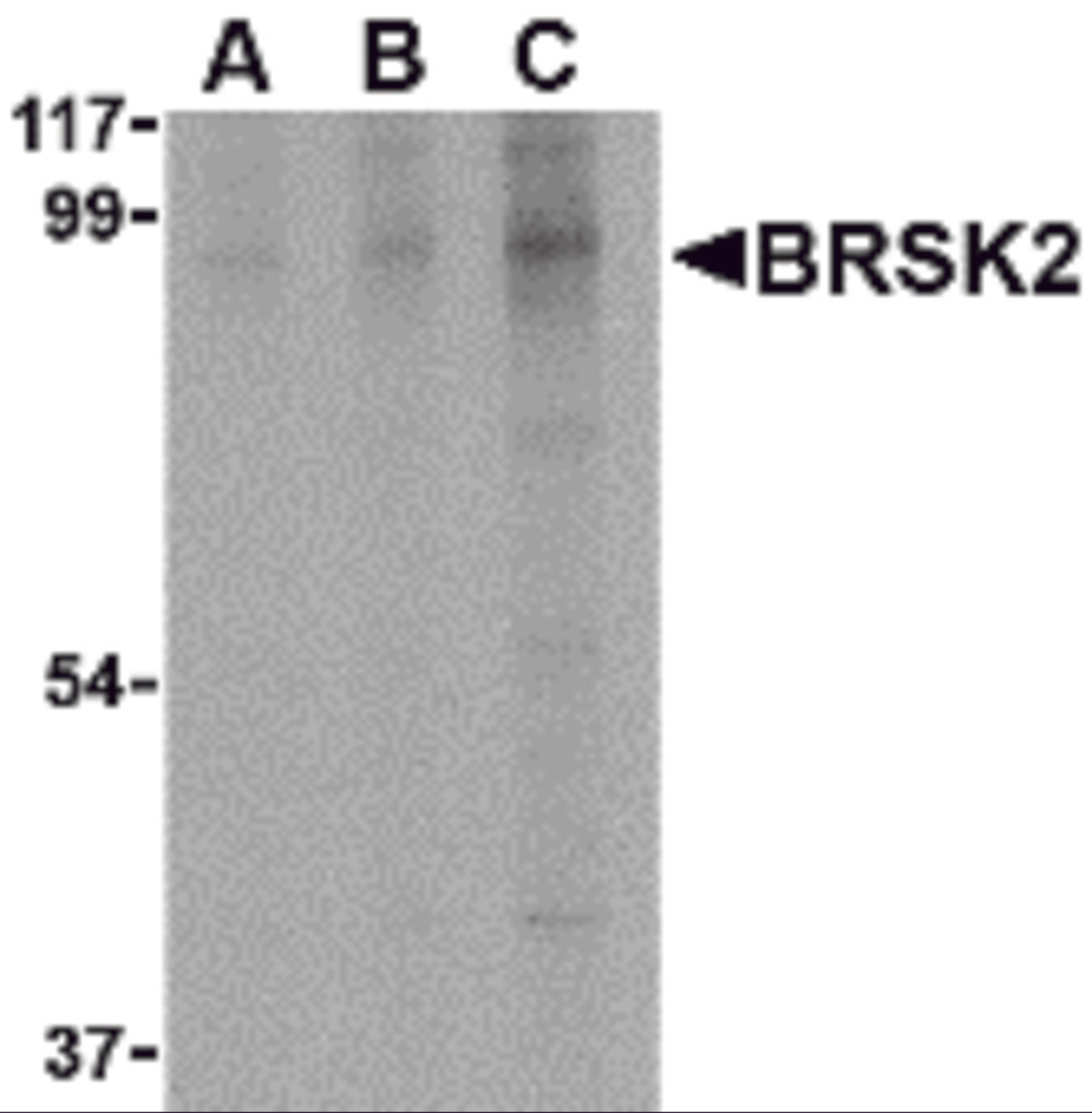 Western blot analysis of BRSK2 in human brain tissue lysate with BRSK2 antibody at (A) 0.5, (B) 1 and (C) 2 μg/mL.