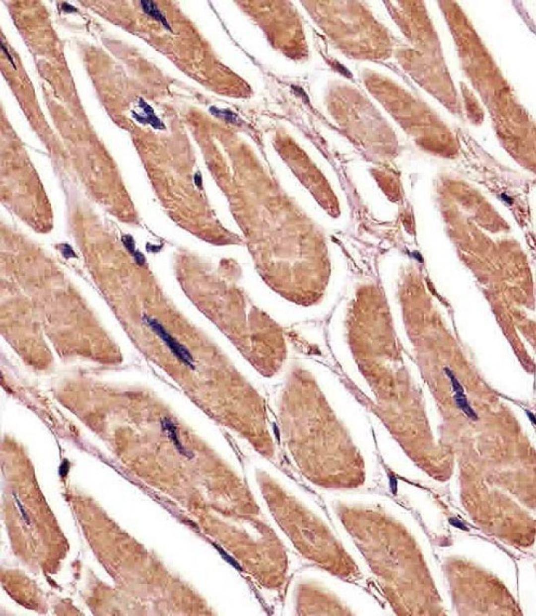 Antibody staining ACTA1/alpha-actin in human heart tissue sections by Immunohistochemistry (IHC-P - paraformaldehyde-fixed, paraffin-embedded sections).