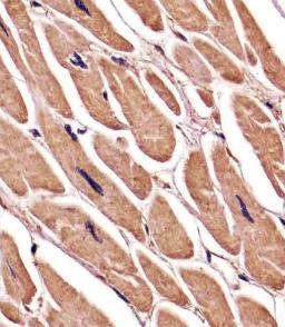 Antibody staining ACTA1/alpha-actin in human heart tissue sections by Immunohistochemistry (IHC-P - paraformaldehyde-fixed, paraffin-embedded sections).