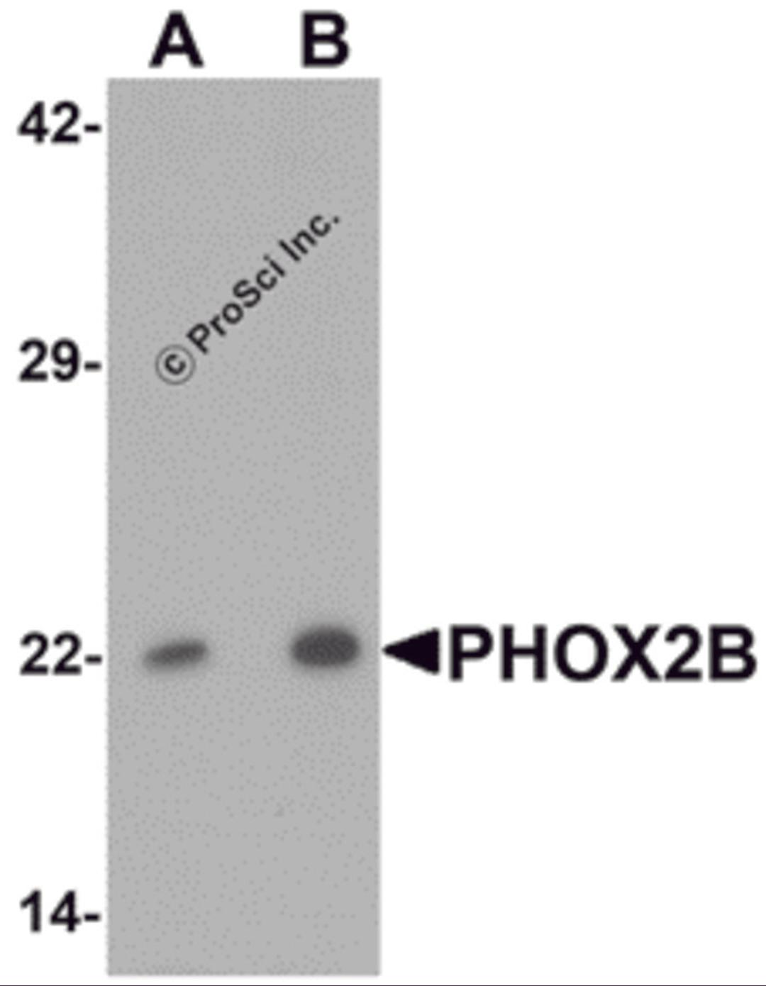 Western blot analysis of PHOX2B in 293 cell lysate with PHOX2B antibody at (A) 1 and (B) 2 &#956;g/mL.