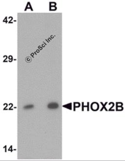 Western blot analysis of PHOX2B in 293 cell lysate with PHOX2B antibody at (A) 1 and (B) 2 μg/mL.