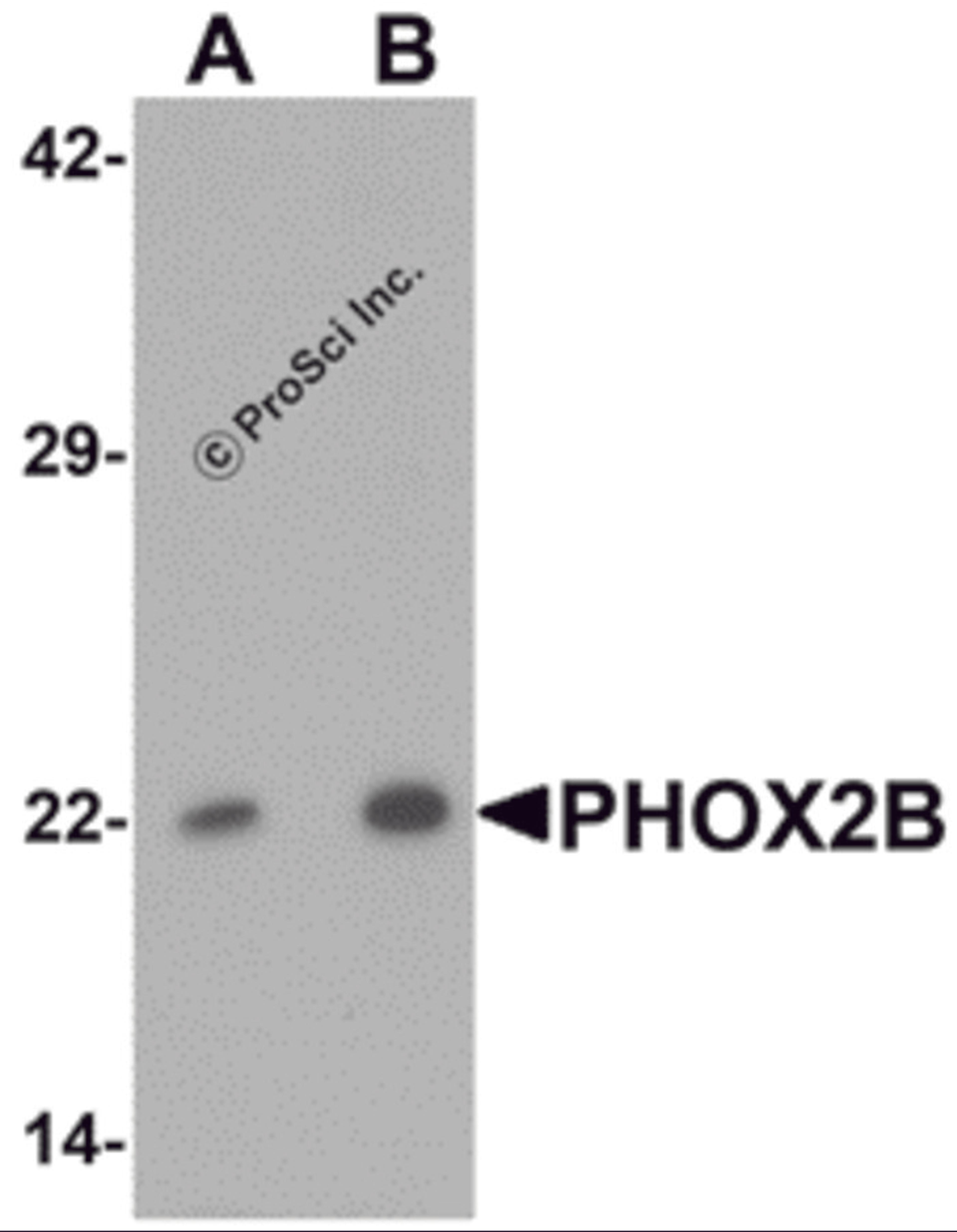 Western blot analysis of PHOX2B in 293 cell lysate with PHOX2B antibody at (A) 1 and (B) 2 μg/mL.
