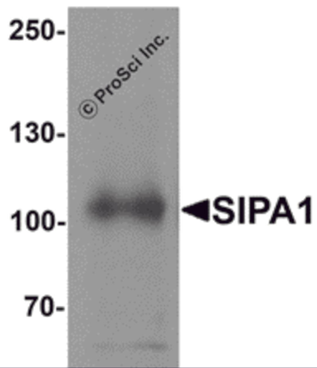 Western blot analysis of SIPA1 in human brain tissue lysate with SIPA1 antibody at 1 &#956;g/mL.