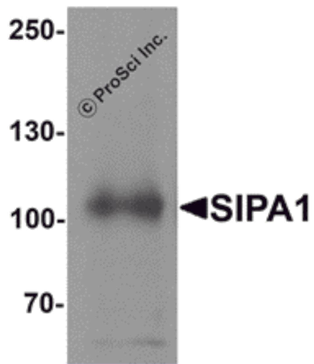 Western blot analysis of SIPA1 in human brain tissue lysate with SIPA1 antibody at 1 μg/mL.