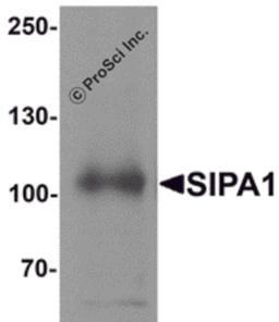 Western blot analysis of SIPA1 in human brain tissue lysate with SIPA1 antibody at 1 μg/mL.