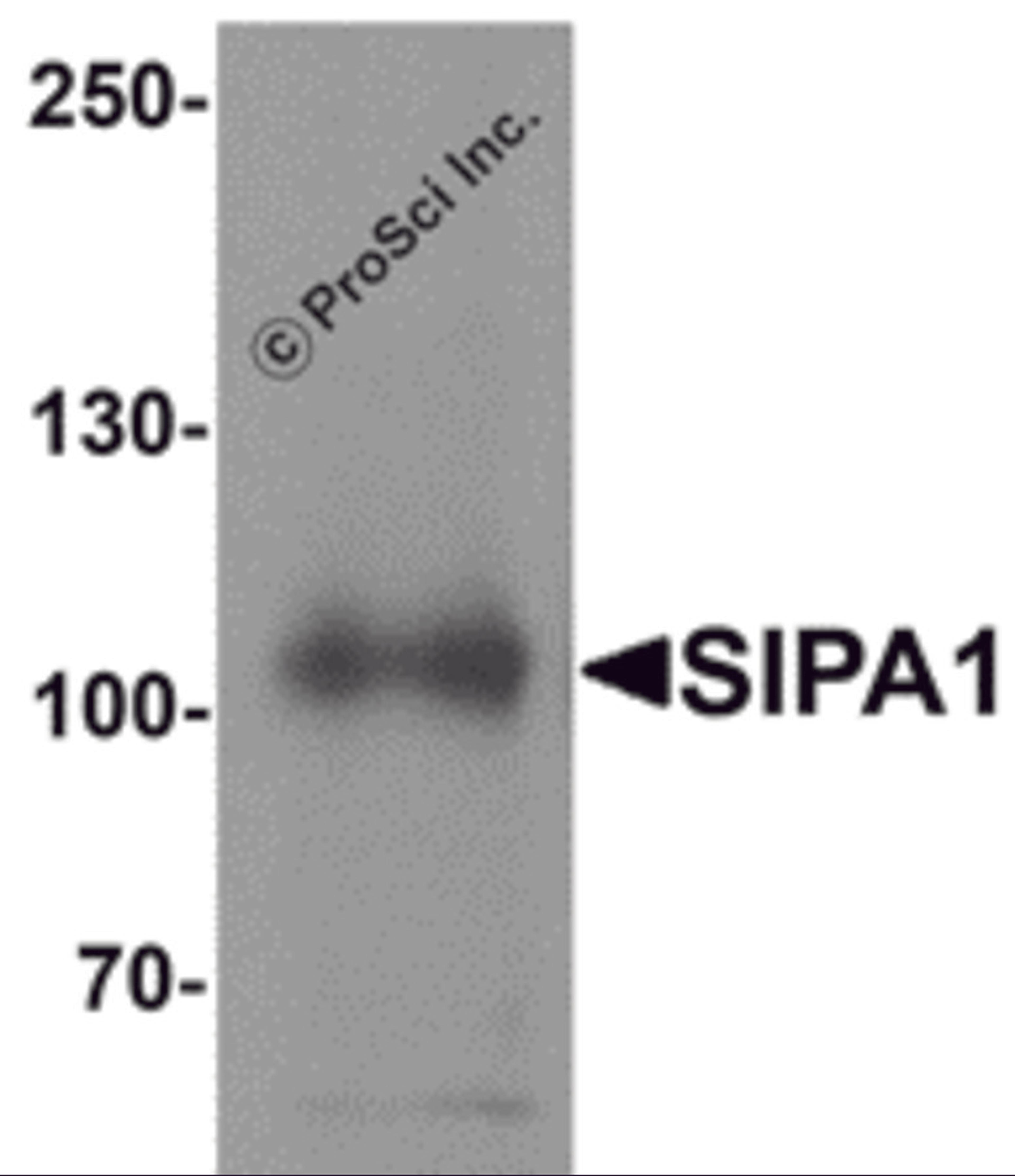 Western blot analysis of SIPA1 in human brain tissue lysate with SIPA1 antibody at 1 μg/mL.