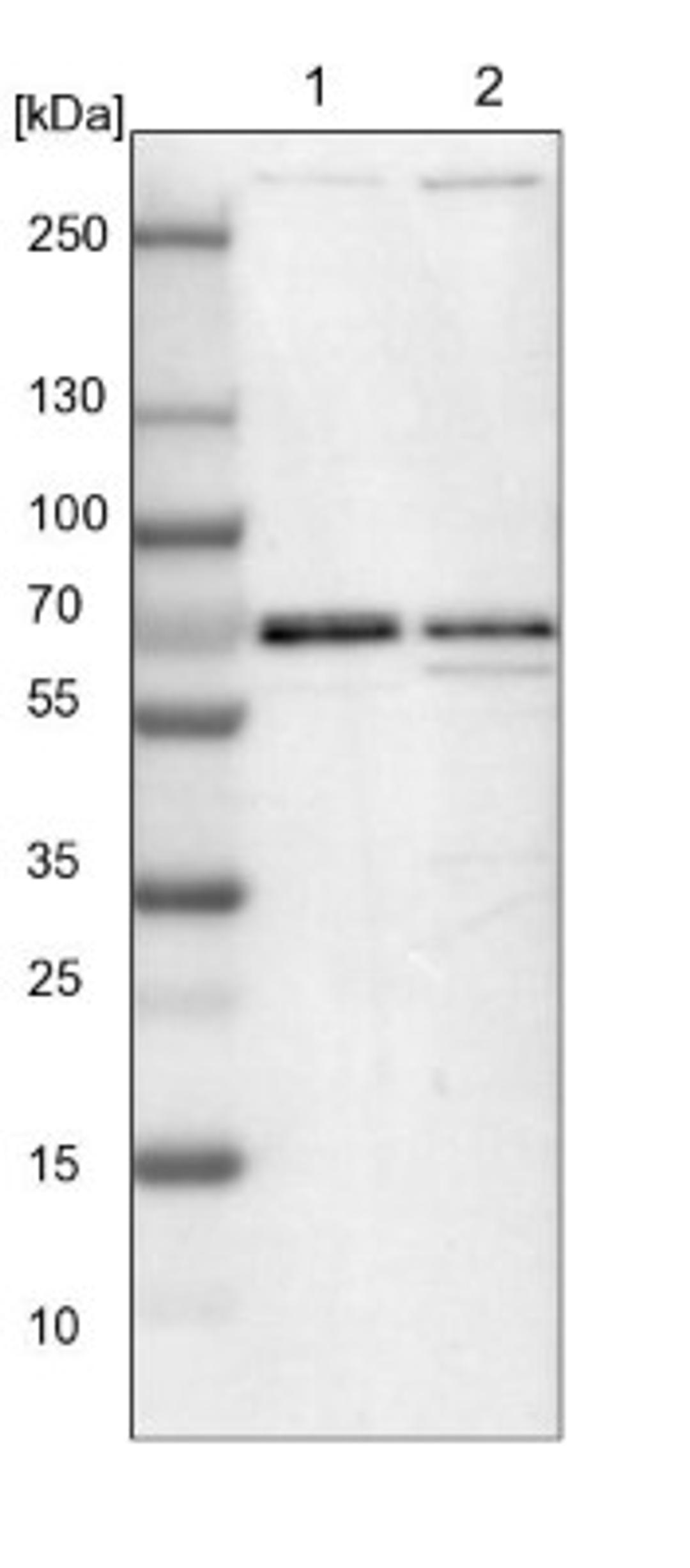 Western Blot: LCA5L Antibody [NBP1-88281] - Lane 1: NIH-3T3 cell lysate (Mouse embryonic fibroblast cells)<br/>Lane 2: NBT-II cell lysate (Rat Wistar bladder tumour cells)