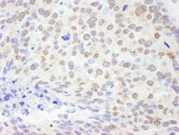 Detection of human DDX1 by immunohistochemistry.