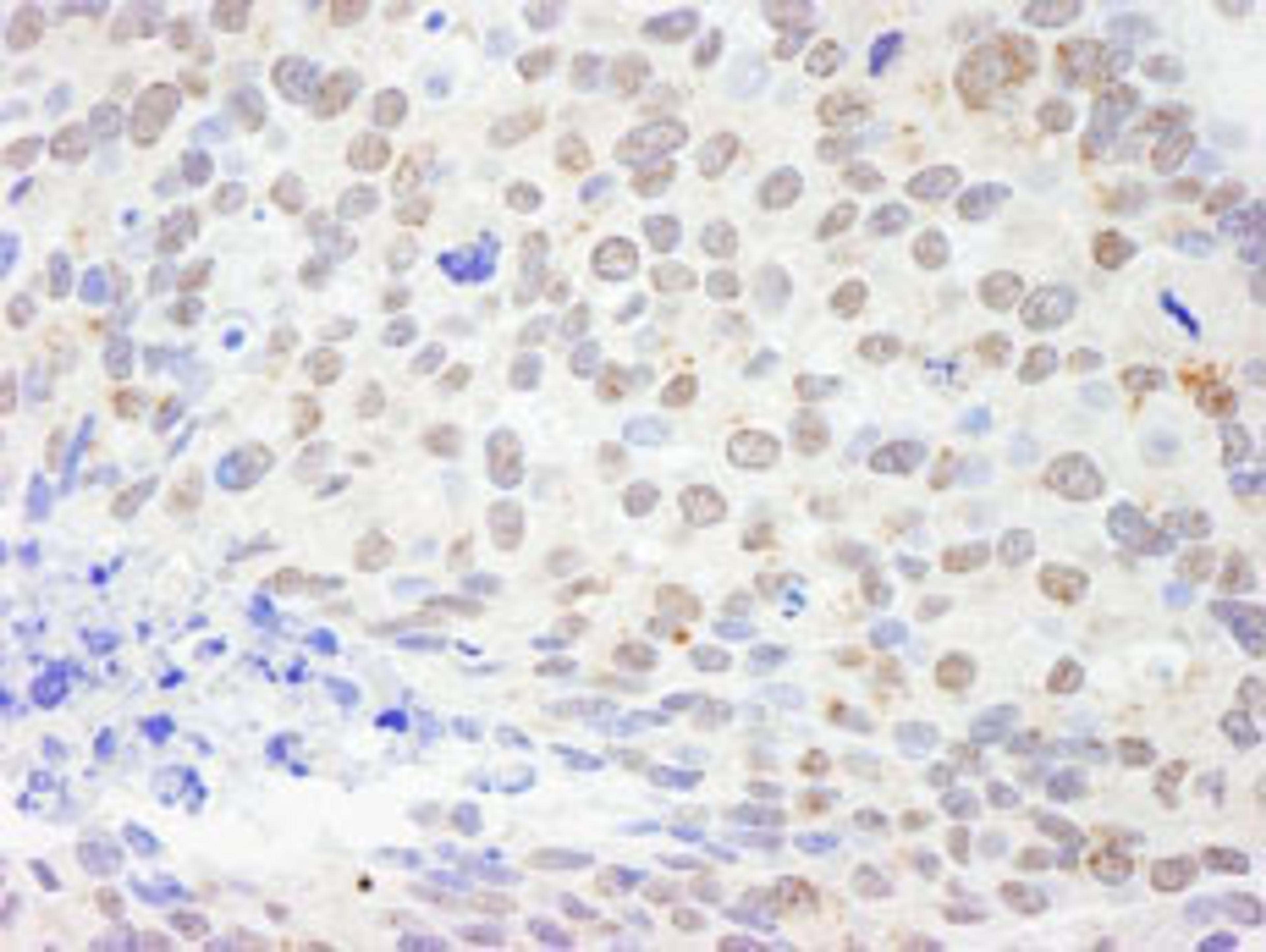 Detection of human DDX1 by immunohistochemistry.