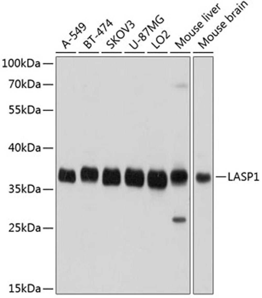 Western blot - LASP1 antibody (A3941)