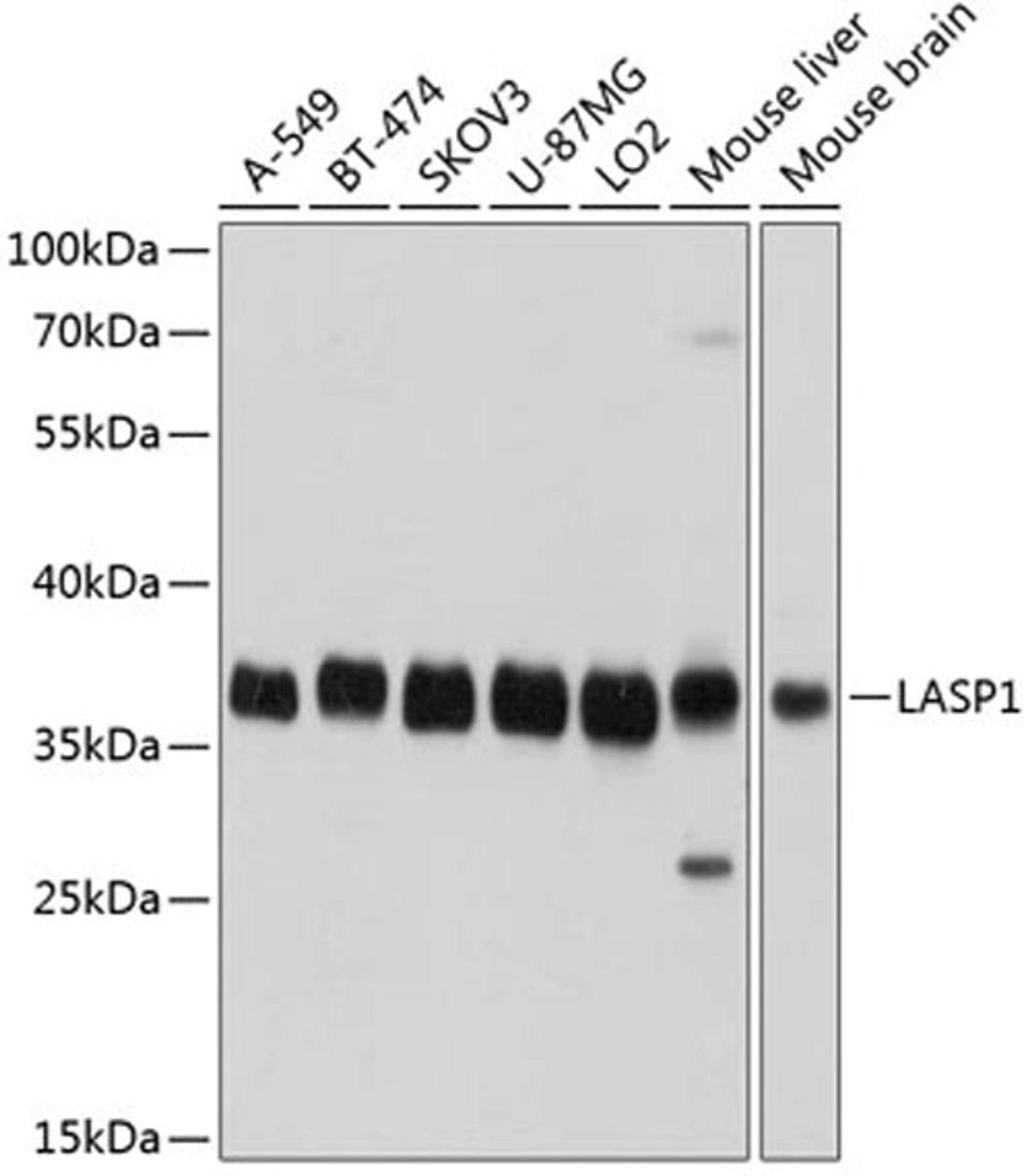 Western blot - LASP1 antibody (A3941)