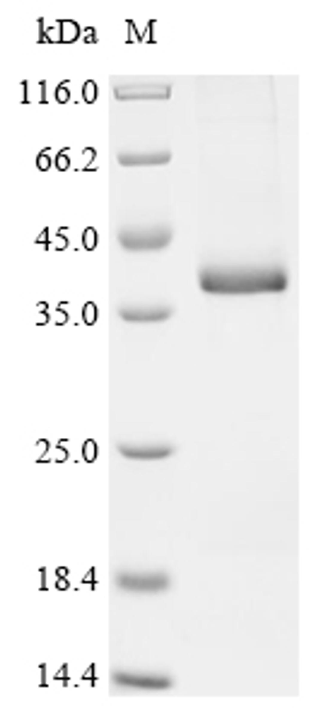 (Tris-Glycine gel) Discontinuous SDS-PAGE (reduced) with 5% enrichment gel and 15% separation gel.