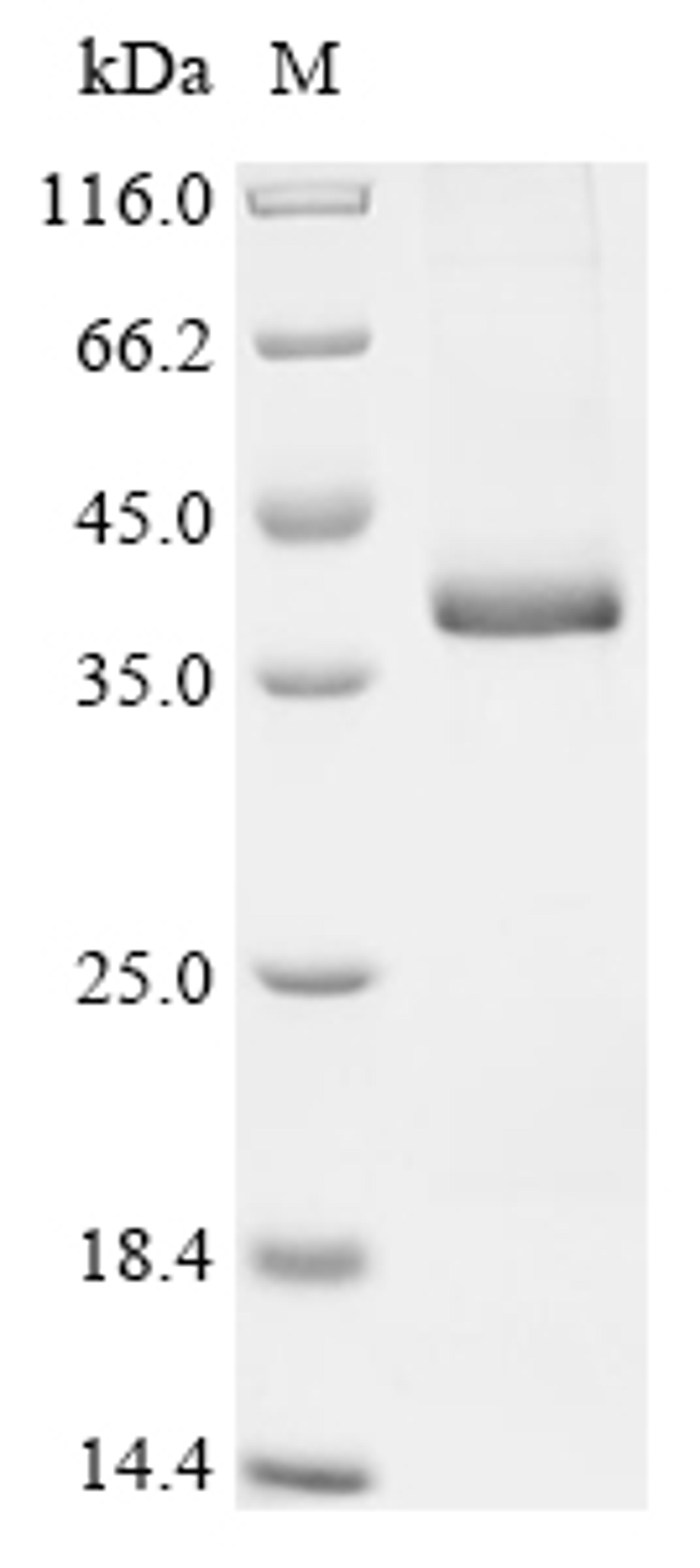 (Tris-Glycine gel) Discontinuous SDS-PAGE (reduced) with 5% enrichment gel and 15% separation gel.