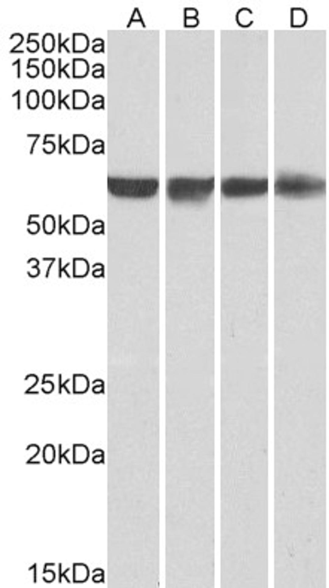 46-243 (0.01ug/ml) staining of HeLa (A), HepG2 (B), Jurkat (C) and HEK293 (D) nuclear lysates (35ug protein in RIPA buffer). Primary incubation was 1 hour. Detected by chemiluminescence.