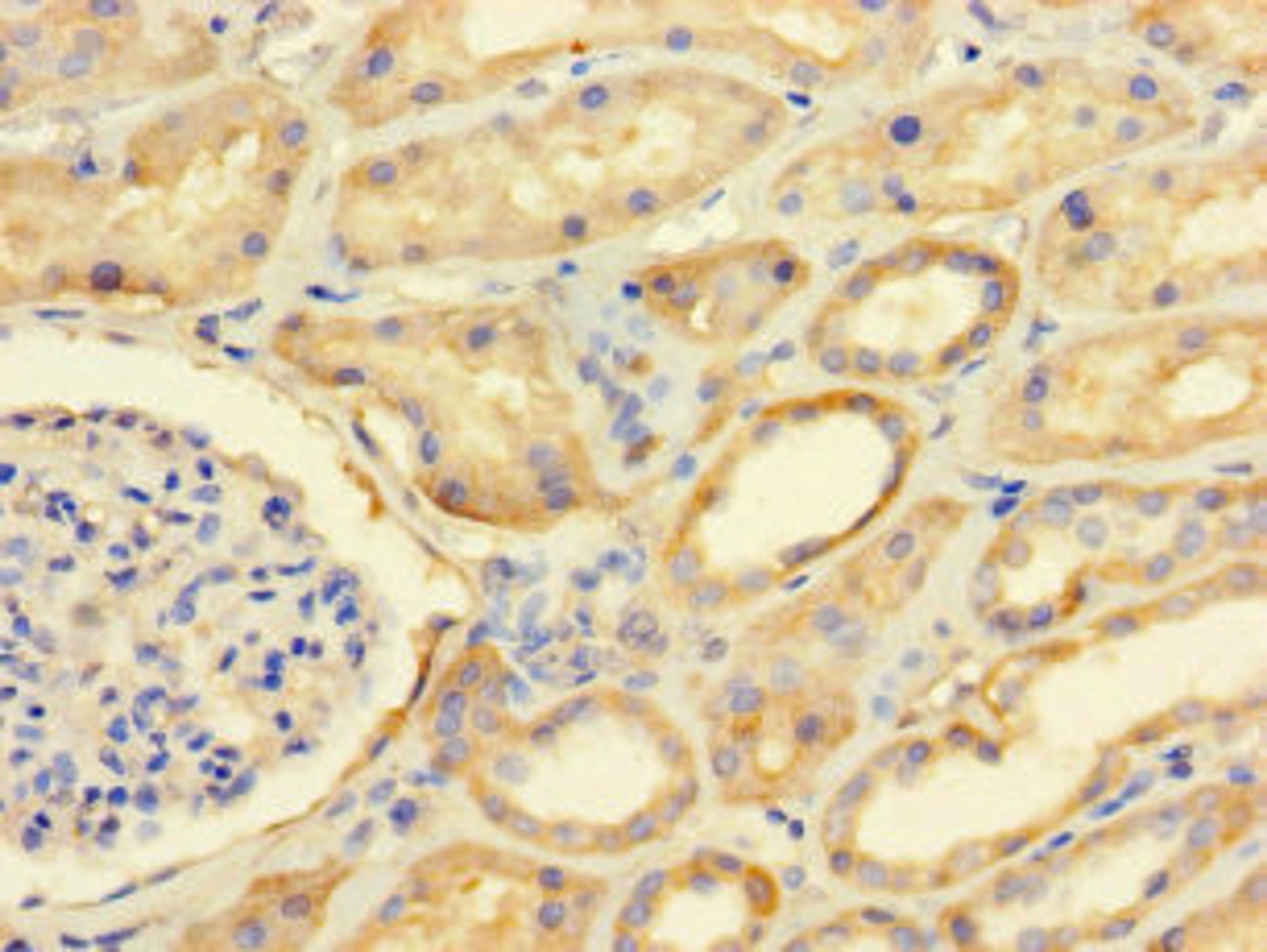 Immunohistochemistry of paraffin-embedded human kidney tissue using CSB-PA810307LA01HU at dilution of 1:100