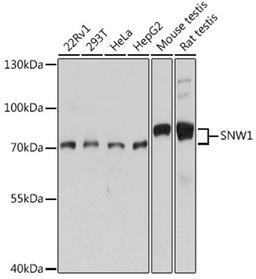 Western blot - SNW1 antibody (A14580)