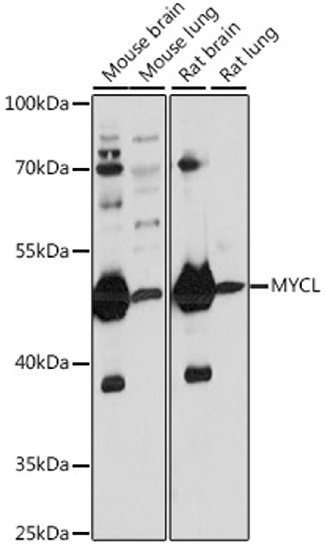 Western blot - MYCL antibody (A16301)