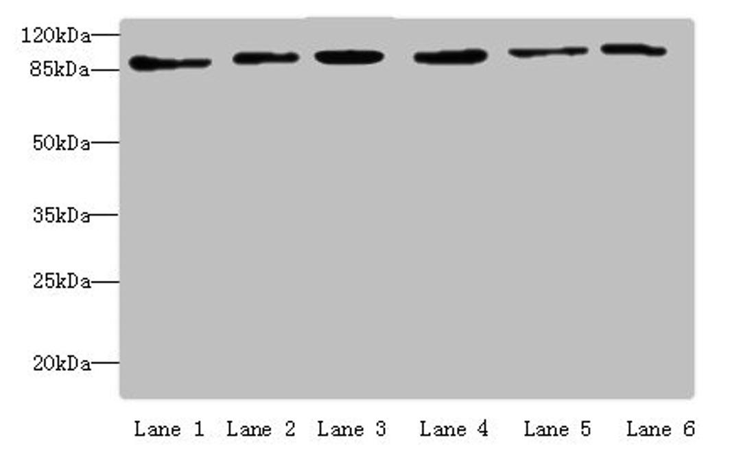 Western blot. All lanes: MCM3 antibody at 4 ug/ml. Lane 1: Hela whole cell lysate. Lane 2: 293T whole cell lysate. Lane 3: K562 whole cell lysate. Lane 4: HepG2 whole cell lysate. Lane 5: Jurkats whole cell lysate. Lane 6: U917 whole cell lysate. Secondary. Goat polyclonal to rabbit IgG at 1/10000 dilution. Predicted band size: 91, 96 kDa. Observed band size: 91 kDa. 