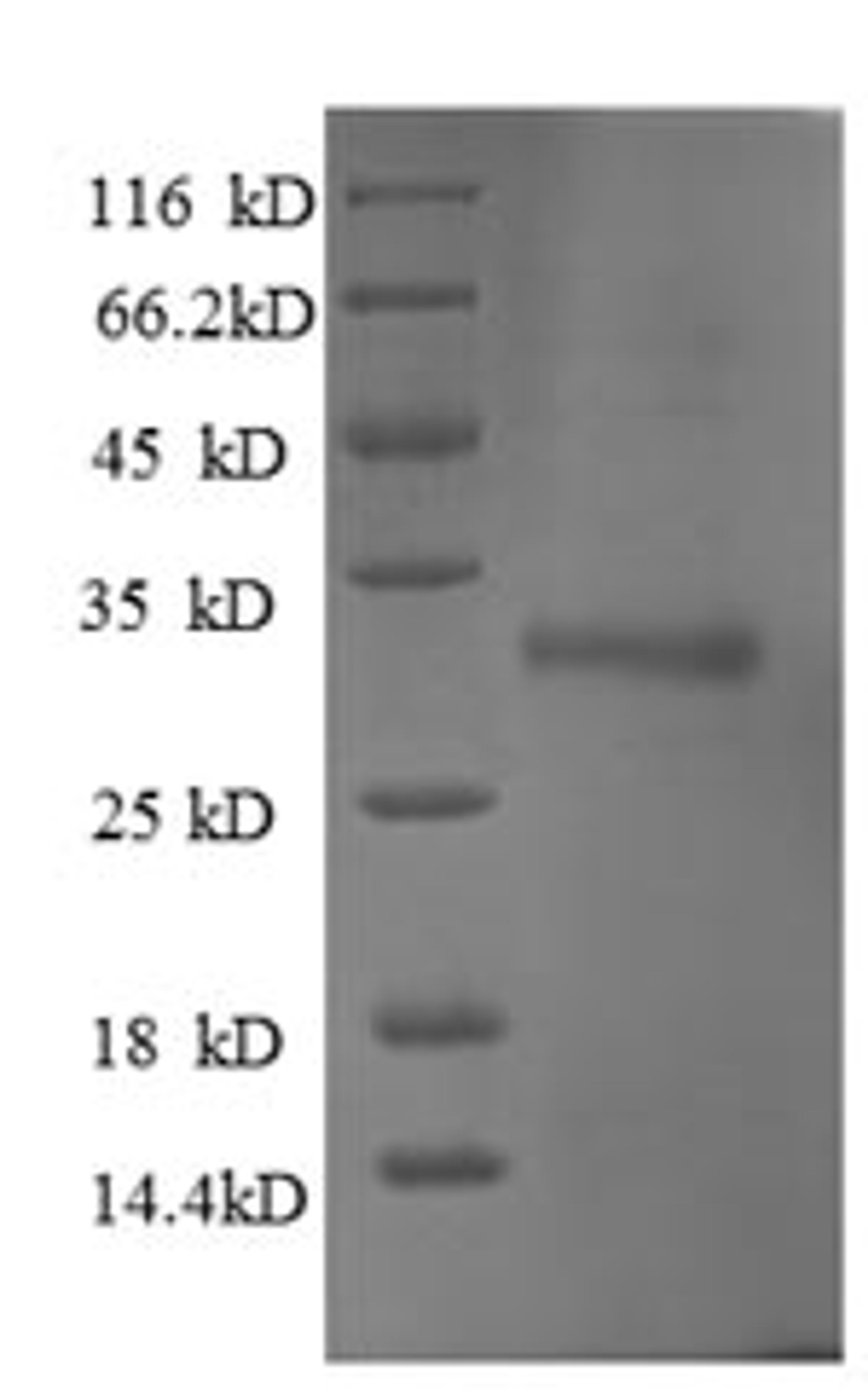 (Tris-Glycine gel) Discontinuous SDS-PAGE (reduced) with 5% enrichment gel and 15% separation gel.
