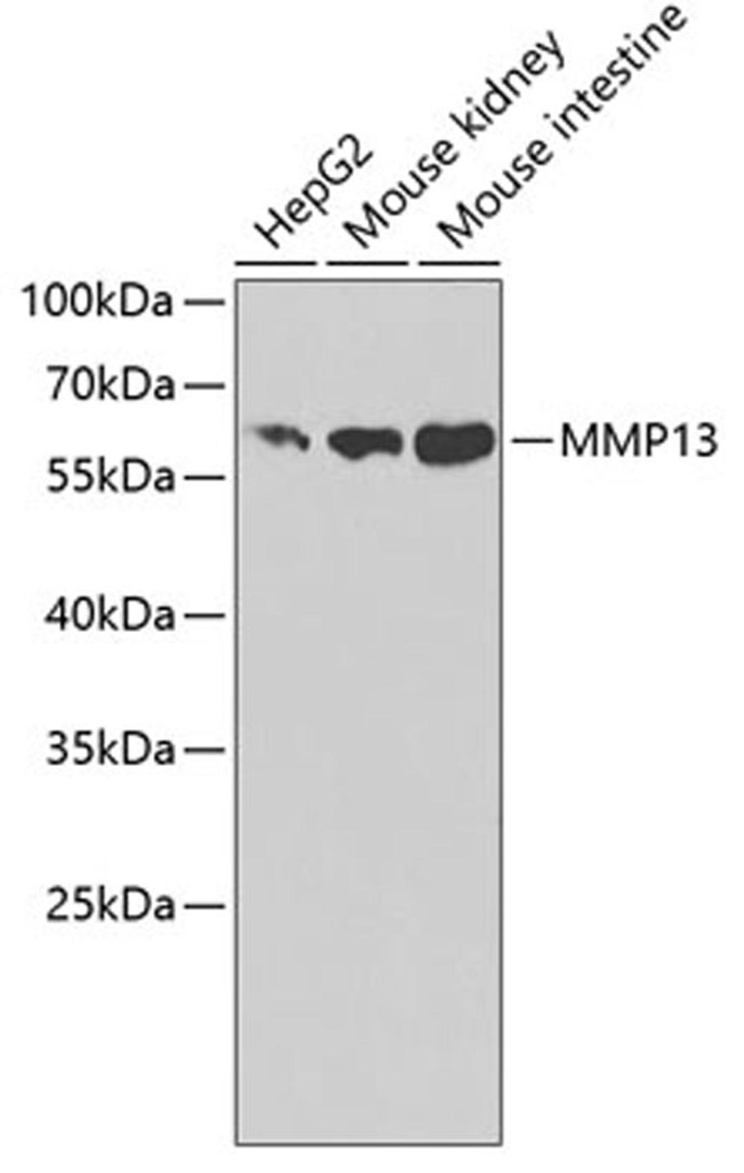 Western blot - MMP13 antibody (A1606)