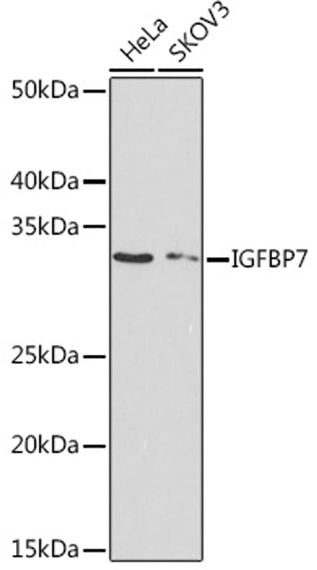 Western blot - IGFBP7 Rabbit mAb (A4615)