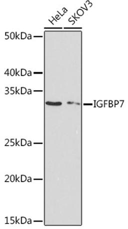 Western blot - IGFBP7 Rabbit mAb (A4615)