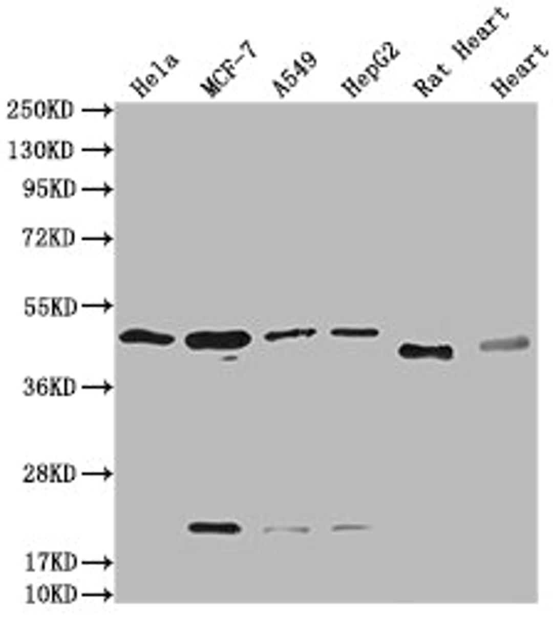 Western Blot. Positive WB detected in: Hela whole cell lysate, MCF-7 whole cell lysate, A549 whole cell lysate, HepG2 whole cell lysate, Rat Heart tissue, Mouse Heart tissue. All lanes: HTR3E antibody at 1:2000. Secondary. Goat polyclonal to rabbit IgG at 1/50000 dilution. Predicted band size: 52, 50, 53, 51, 54 kDa. Observed band size: 50 kDa. 