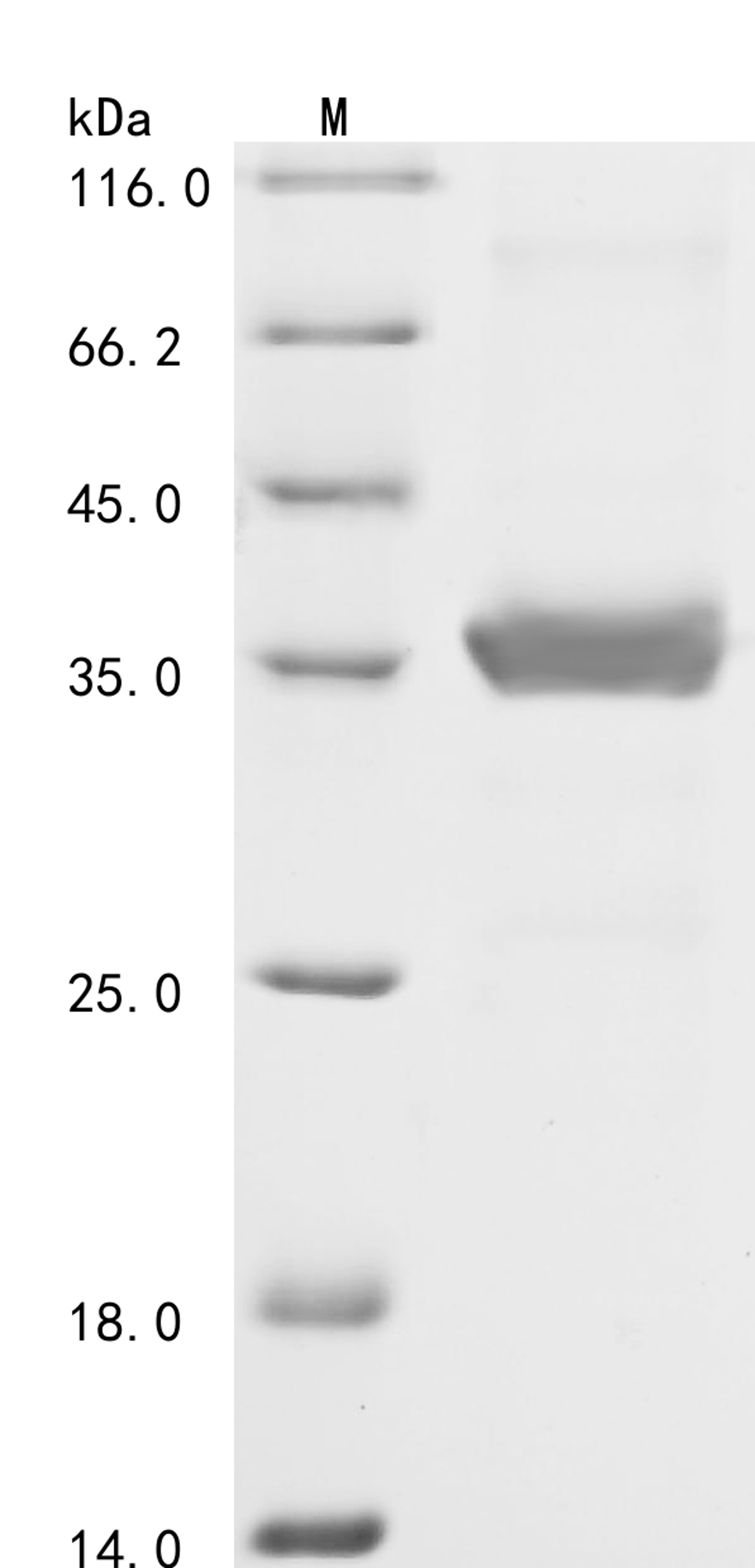 (Tris-Glycine gel) Discontinuous SDS-PAGE (reduced) with 5% enrichment gel and 15% separation gel.
