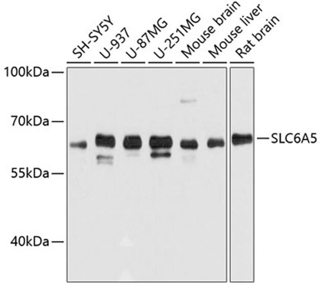 Western blot - SLC6A5 antibody (A11647)