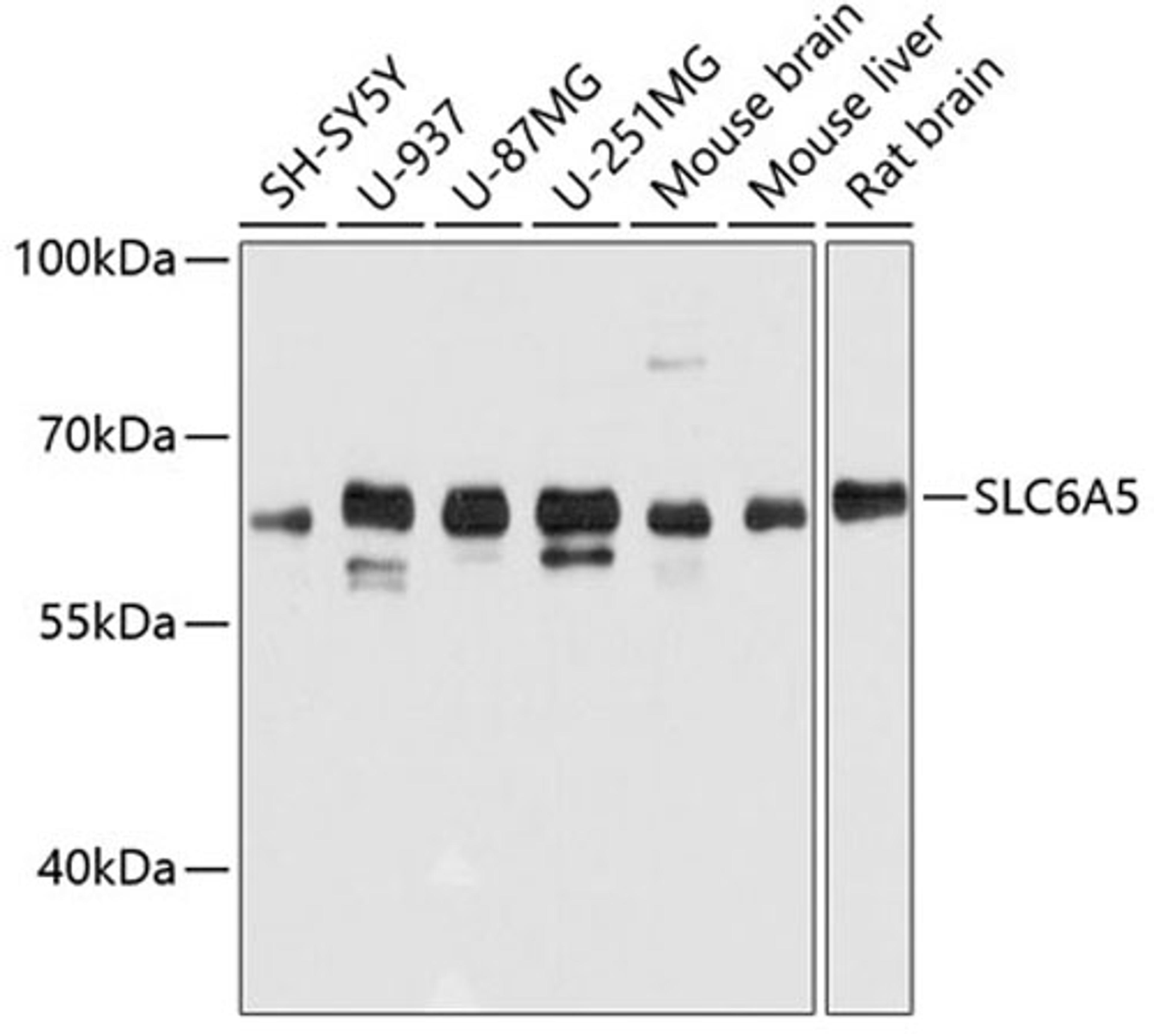 Western blot - SLC6A5 antibody (A11647)