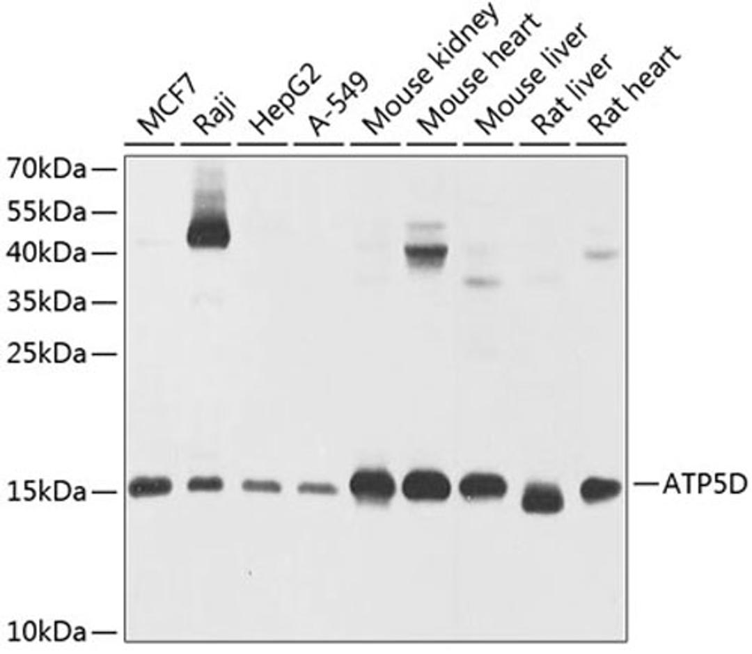 Western blot - ATP5D antibody (A9929)