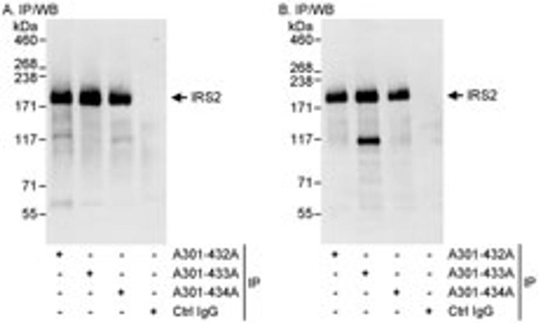 Detection of human IRS2 by western blot of immunoprecipitates.