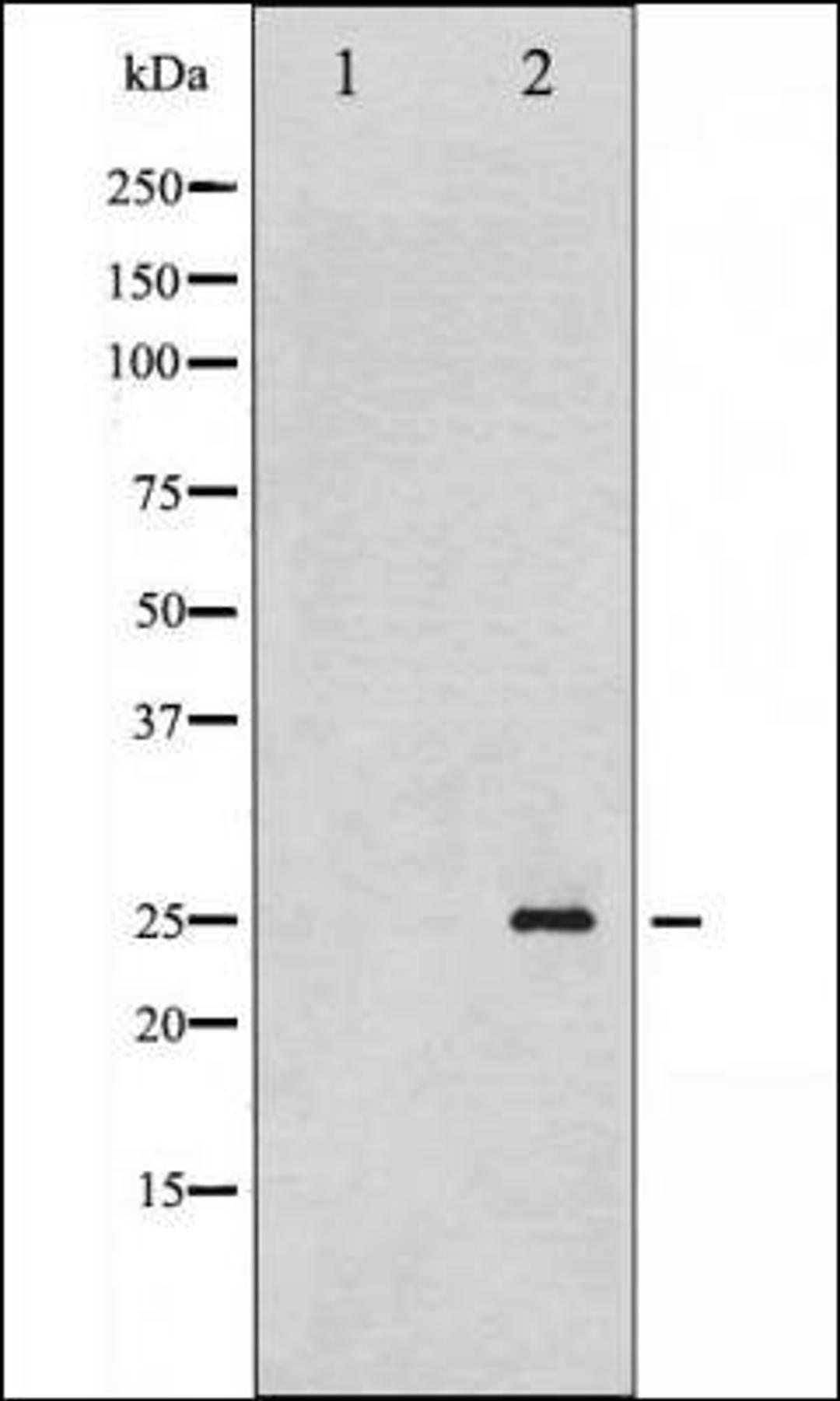 Western blot analysis of EGF treated HeLa whole cell lysates using p21 Cip1 -Phospho-Thr145- antibody