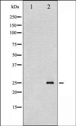 Western blot analysis of EGF treated HeLa whole cell lysates using p21 Cip1 -Phospho-Thr145- antibody