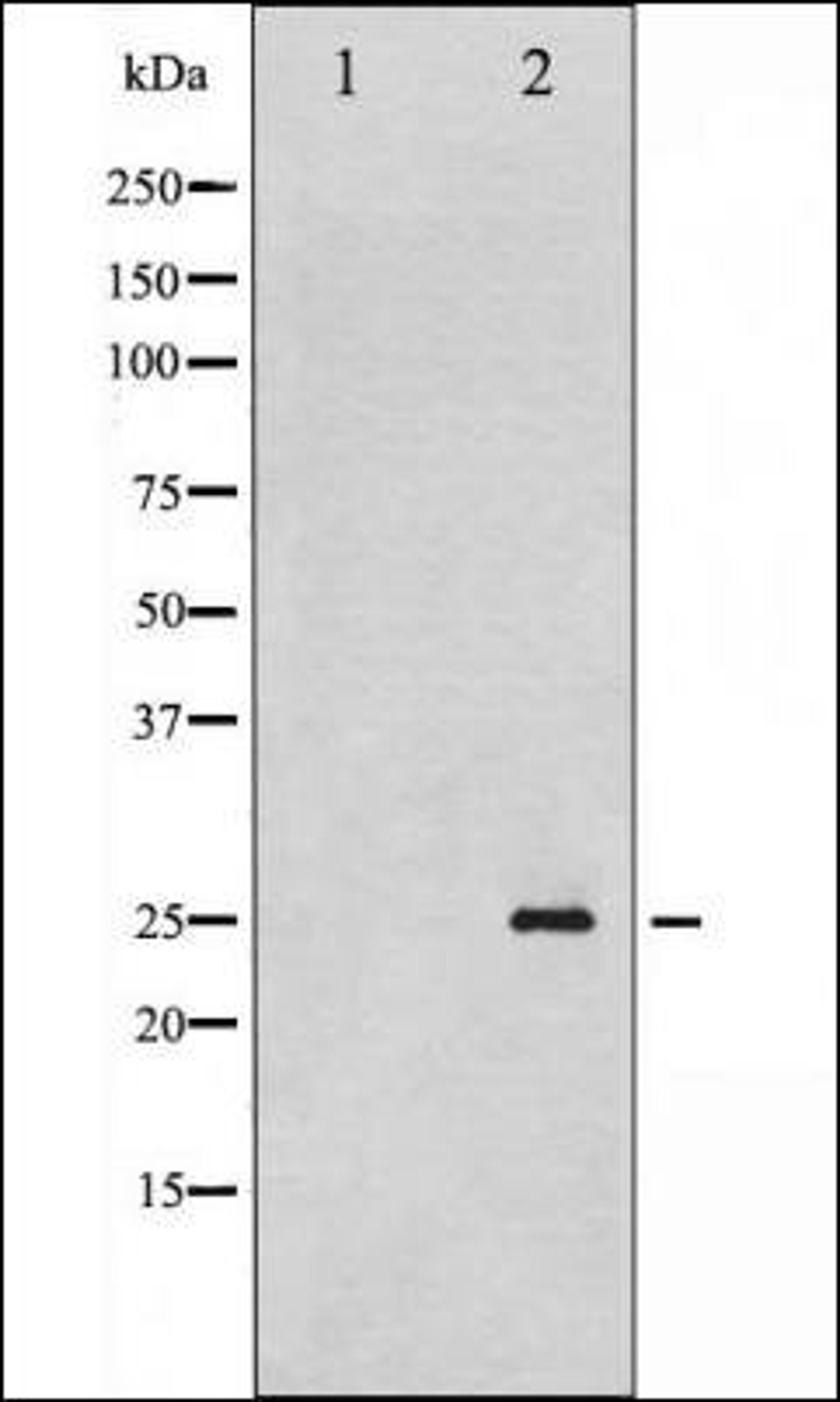 Western blot analysis of EGF treated HeLa whole cell lysates using p21 Cip1 -Phospho-Thr145- antibody