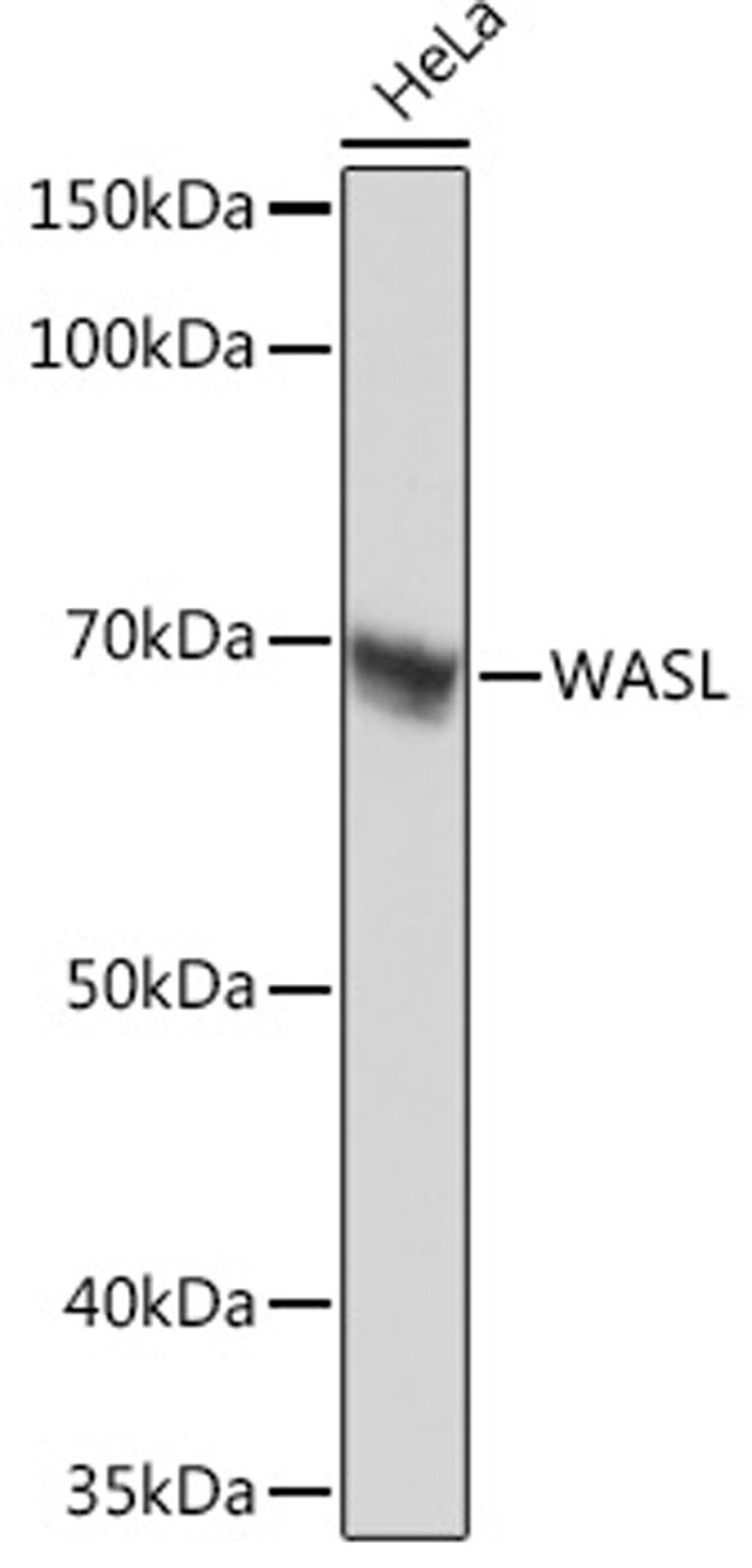 Western blot - WASL Rabbit mAb (A2270)